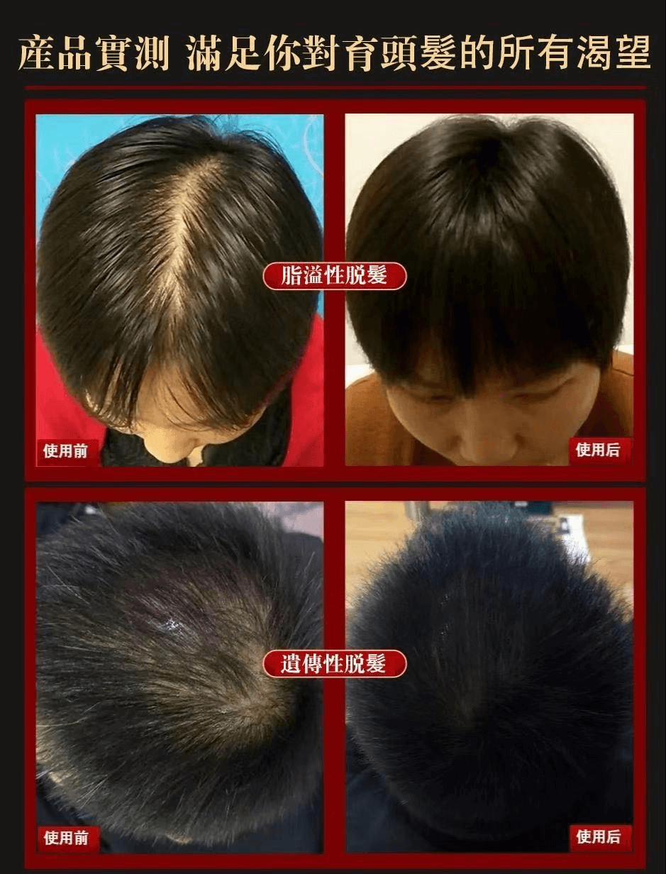 白黑客防脫育髮液1709362947212491.png 白黑客防脫育髮液