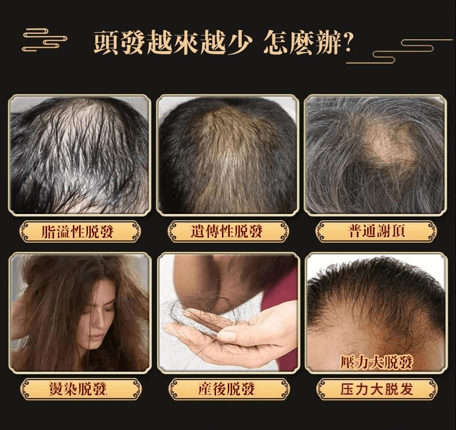 白黑客防脫育髮液1709362947500517.png 白黑客防脫育髮液