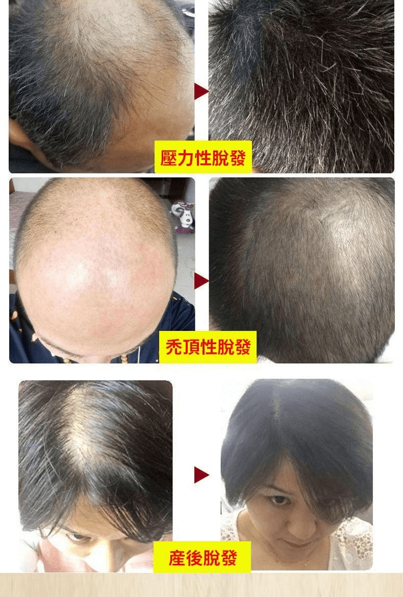 白黑客防脫育髮液1709362947704770.png 白黑客防脫育髮液