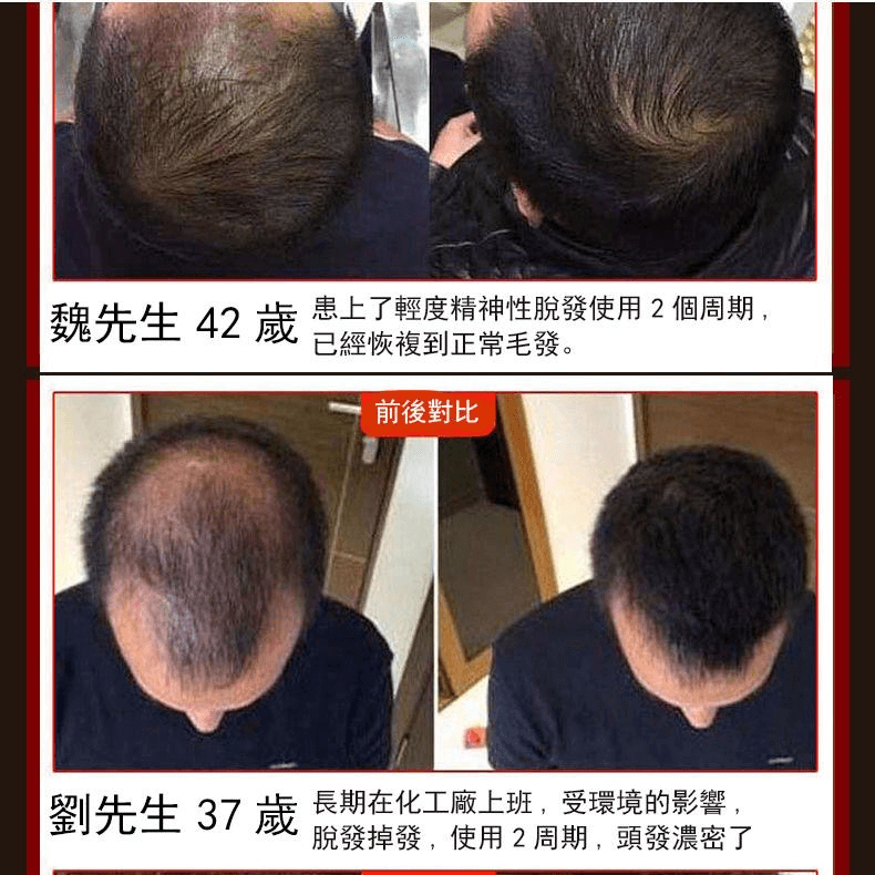 白黑客防脫育髮液1709362947792029.png 白黑客防脫育髮液