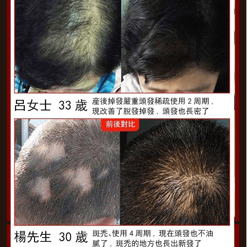 白黑客防脫育髮液709362947819096.png 白黑客防脫育髮液